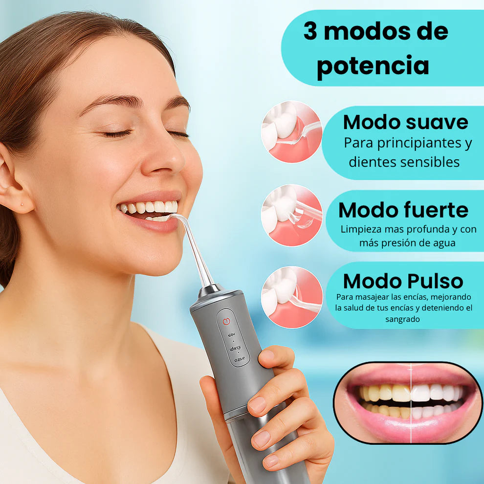 Irrigador Bucal Portátil – Limpieza profunda